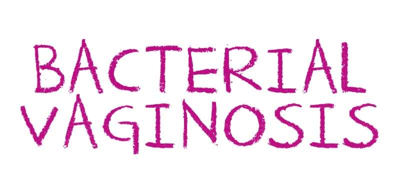 Bacterial Vaginosis - ලිංගාශ්‍රිත ප්‍රදේශයේ ඇතිවන රෝගී තත්ත්වයන්